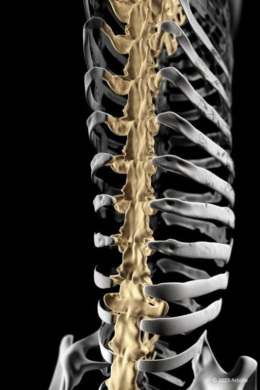 X-Ray 2