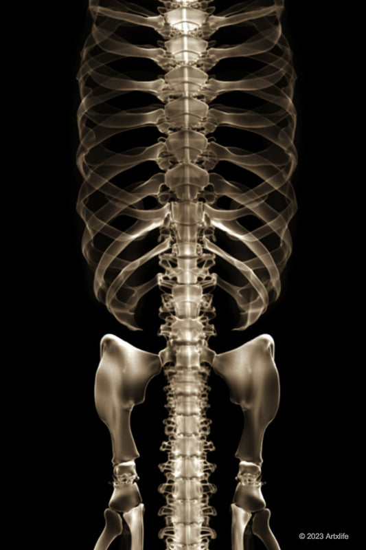X-Ray 3