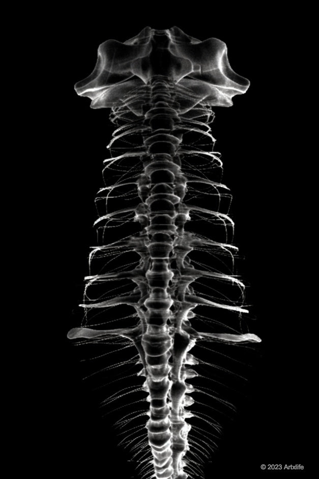 X-Ray 7