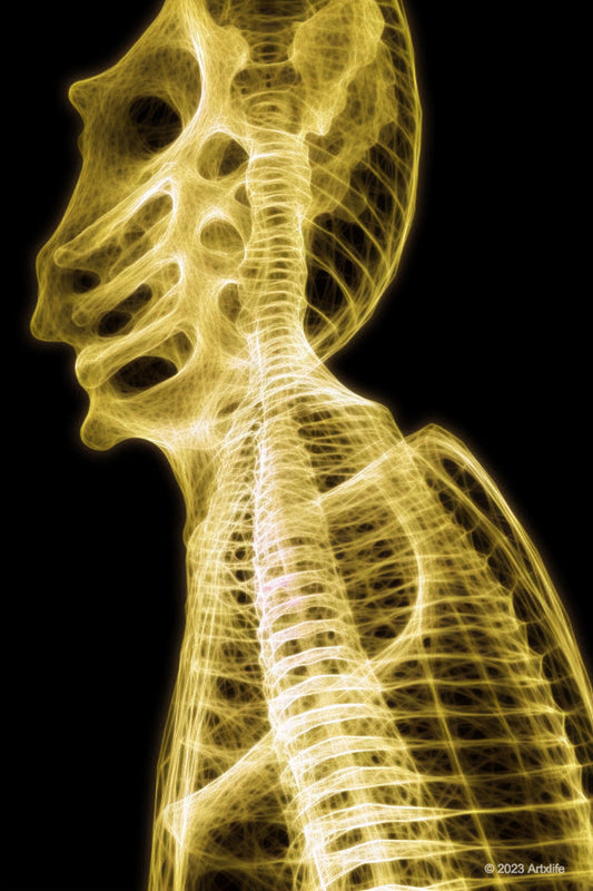 X-Ray 26