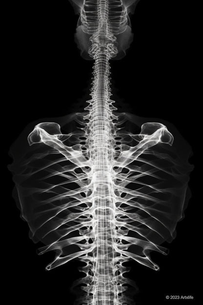 X-Ray 8
