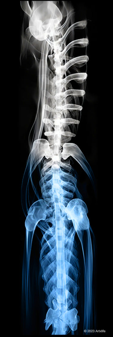 X-ray 35