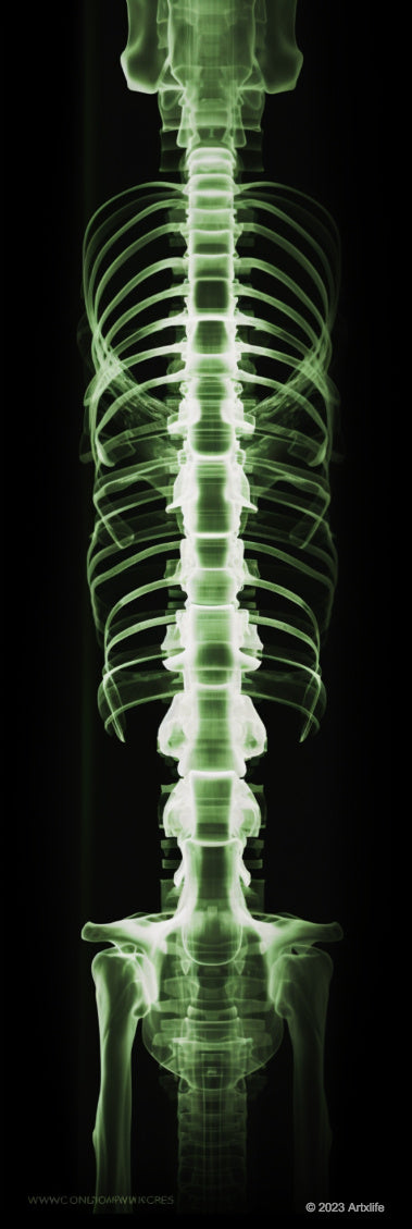 X-ray 32