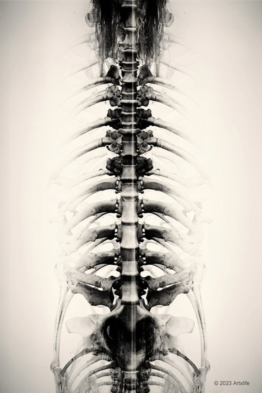 X-Ray 13