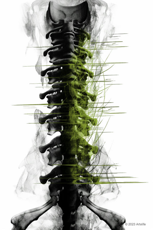 X-Ray 15